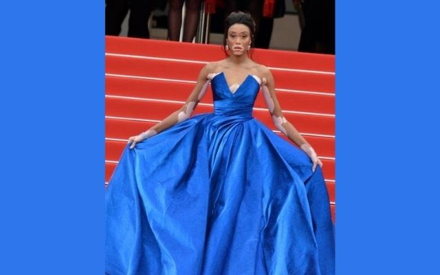 Winnie Harlow wearing blue dress